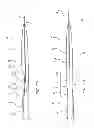 Fig. 08 - Biasing laser catheter: monorail design