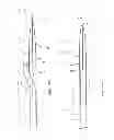 Fig. 09 - Biasing laser catheter: monorail design
