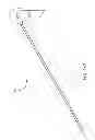 Fig. 11 - Biasing laser catheter: monorail design