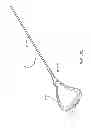 Fig. 12 - Biasing laser catheter: monorail design