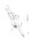Fig. 13 - Biasing laser catheter: monorail design