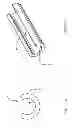 Fig. 14 - Biasing laser catheter: monorail design