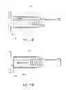 Fig. 19 - Biasing laser catheter: monorail design