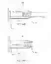 Fig. 20 - Biasing laser catheter: monorail design
