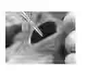 Fig. 07 - Microwave surgical instrument
