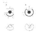 Fig. 08 - Microwave surgical instrument