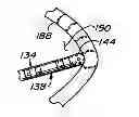 Fig. 01 - Method and apparatus for controlling lesion size in catheter-based ablation