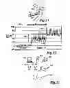 Fig. 07 - Method and apparatus for controlling lesion size in catheter-based ablation