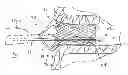 Fig. 01 - Apparatus and method for treating cardiovascular diseases