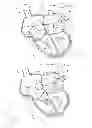 Fig. 11 - Apparatus and method for treating cardiovascular diseases