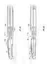 Fig. 12 - In-line vessel sealer and divider