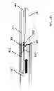 Fig. 14 - ELECTROSURGICAL END EFFECTOR WITH INDEPENDENT CLOSURE FEATURE AND BLADE