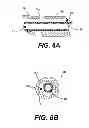 Fig. 06 - Orthopedic fastener device