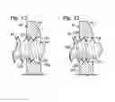 Fig. 08 - Bone fixation system with opposed mounting portions