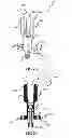 Fig. 03 - GLENOID AUGMENT PREPARATION INSTRUMENT