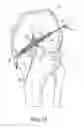 Fig. 23 - System for ACL reconstruction using retrograde cutter