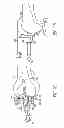 Fig. 06 - Distal resection systems and methods