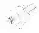 Fig. 02 - Catheter with integrated cement delivery balloon
