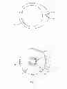 Fig. 03 - Catheter with integrated cement delivery balloon