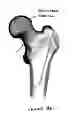 Fig. 05 - Device, Composition and Method for Prevention of Bone Fracture and Pain