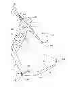 Fig. 01 - Surgical aiming device