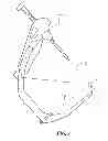 Fig. 04 - Surgical aiming device