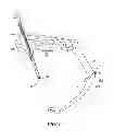 Fig. 05 - Surgical aiming device