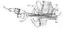 Fig. 01 - System and method for the simultaneous automated bilateral delivery of pressure equalization tubes