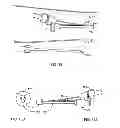 Fig. 07 - System and method for the simultaneous automated bilateral delivery of pressure equalization tubes
