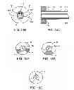 Fig. 08 - System and method for the simultaneous automated bilateral delivery of pressure equalization tubes