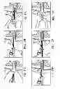Fig. 10 - System and method for the simultaneous automated bilateral delivery of pressure equalization tubes
