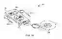 Fig. 12 - System and method for the simultaneous automated bilateral delivery of pressure equalization tubes