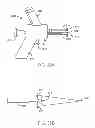 Fig. 22 - System and method for the simultaneous automated bilateral delivery of pressure equalization tubes