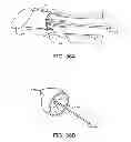 Fig. 23 - System and method for the simultaneous automated bilateral delivery of pressure equalization tubes