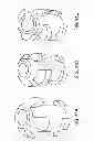 Fig. 26 - System and method for the simultaneous automated bilateral delivery of pressure equalization tubes