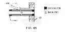 Fig. 28 - System and method for the simultaneous automated bilateral delivery of pressure equalization tubes