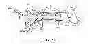 Fig. 31 - System and method for the simultaneous automated bilateral delivery of pressure equalization tubes