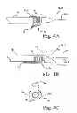 Fig. 05 - Marker delivery device for tissue marker placement