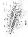 Fig. 12 - Marker delivery device for tissue marker placement