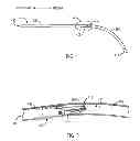 Fig. 04 - Surgical instruments having improved wear resistance, and methods of making the same