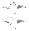 Fig. 07 - Device and method for assisting laparoscopic surgery—rule based approach