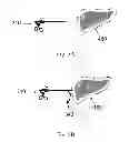 Fig. 08 - Device and method for assisting laparoscopic surgery—rule based approach