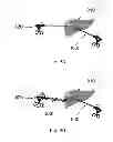 Fig. 14 - Device and method for assisting laparoscopic surgery—rule based approach