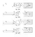 Fig. 24 - Device and method for assisting laparoscopic surgery—rule based approach