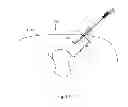 Fig. 25 - Device and method for assisting laparoscopic surgery—rule based approach