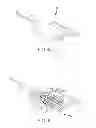 Fig. 08 - Robotic catheter system with dynamic response