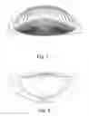 Fig. 08 - Skin cleanser