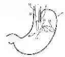 Fig. 01 - ASSEMBLIES FOR DEPLOYING FASTENERS IN TISSUE AND SNARES FOR USE IN SUCH ASSEMBLIES