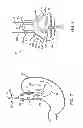 Fig. 05 - ASSEMBLIES FOR DEPLOYING FASTENERS IN TISSUE AND SNARES FOR USE IN SUCH ASSEMBLIES