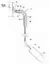 Fig. 01 - Systems and methods for attaching a prosthesis within a body lumen or hollow organ